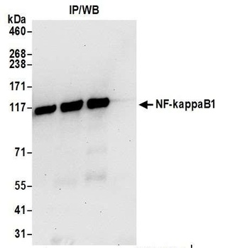 NF-kappaB1 Antibody