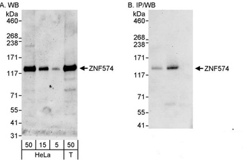 Rabbit anti-ZNF574 Antibody