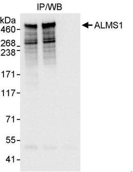 ALMS1 Antibody