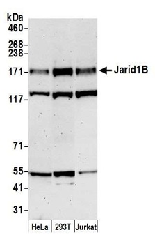 JARID1B Antibody