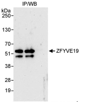 Rabbit anti-ZFYVE19 Antibody