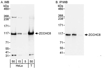 ZCCHC8 Antibody