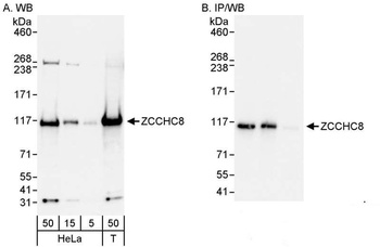 Rabbit anti-ZCCHC8 Antibody