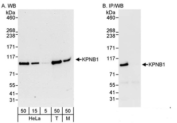 Rabbit anti-KPNB1 Antibody