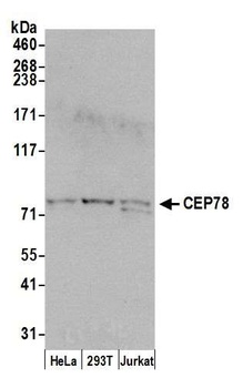 CEP78 Antibody
