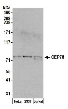 Rabbit anti-CEP78 Antibody