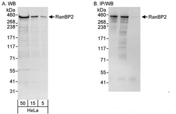 Rabbit anti-RanBP2 Antibody
