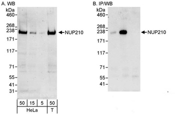 NUP210 Antibody