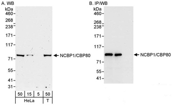 Rabbit anti-NCBP1/CBP80 Antibody