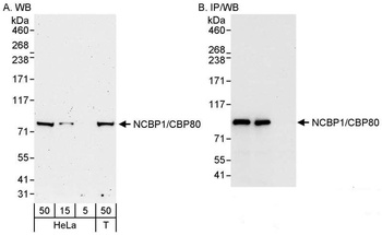 NCBP1/CBP80 Antibody