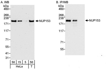 Rabbit anti-NUP153 Antibody