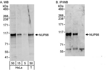 Rabbit anti-NUP98 Antibody