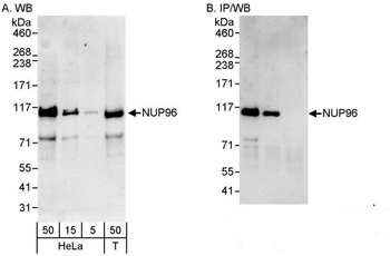 NUP96 Antibody