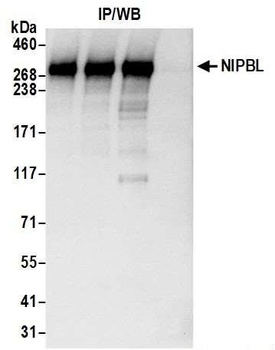 NIPBL Antibody