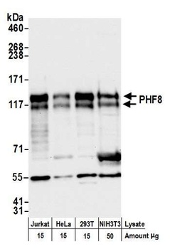 PHF8 Antibody