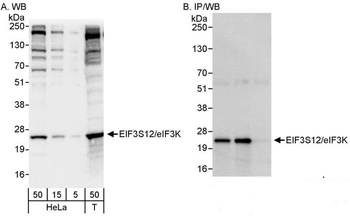 Rabbit anti-eIF3K/EIF3S12 Antibody