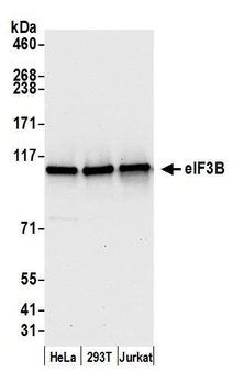 Rabbit anti-eIF3B/EIF3S9 Antibody