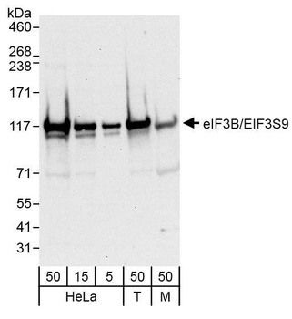 eIF3B/EIF3S9 Antibody