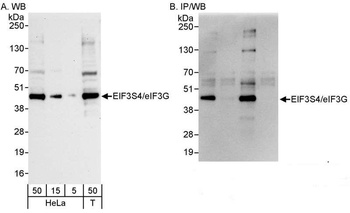 Rabbit anti-eIF3G/EIF3S4 Antibody