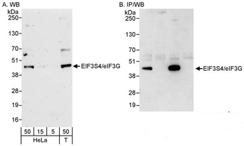 Rabbit anti-eIF3G/EIF3S4 Antibody