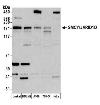 JARID1D/SMCY Antibody