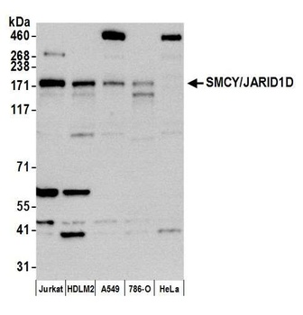 Rabbit anti-JARID1D/SMCY Antibody