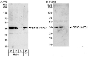 eIF3J/EIF3S1 Antibody