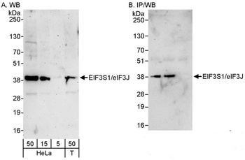 Rabbit anti-eIF3J/EIF3S1 Antibody