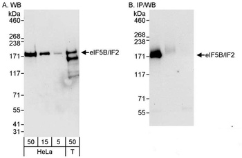 eIF5B/IF2 Antibody