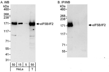 Rabbit anti-eIF5B/IF2 Antibody