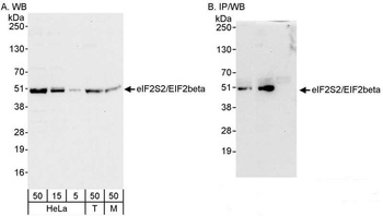 Rabbit anti-eIF2beta/EIF2S2 Antibody