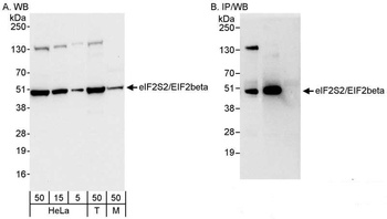 eIF2beta/EIF2S2 Antibody