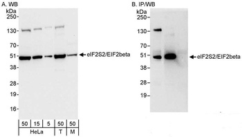Rabbit anti-eIF2beta/EIF2S2 Antibody
