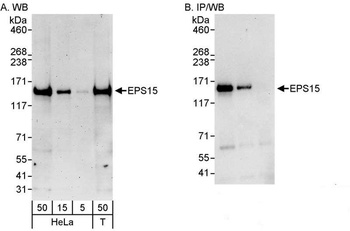 Rabbit anti-EPS15 Antibody