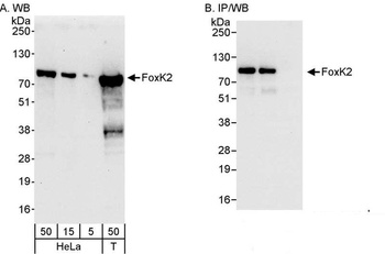 Rabbit anti-FOXK2 Antibody