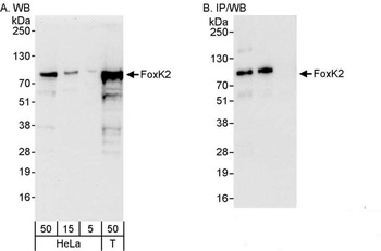 Rabbit anti-FOXK2 Antibody