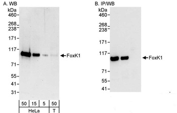 Rabbit anti-FOXK1 Antibody