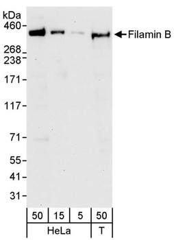 Filamin B Antibody