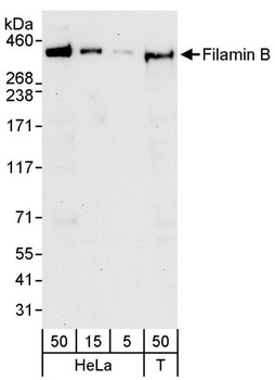 Rabbit anti-Filamin B Antibody