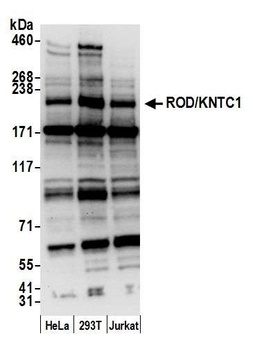 ROD/KNTC1 Antibody