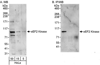 Rabbit anti-eEF2 Kinase Antibody