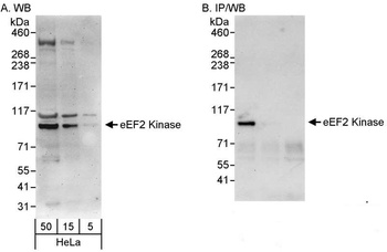 Rabbit anti-eEF2 Kinase Antibody