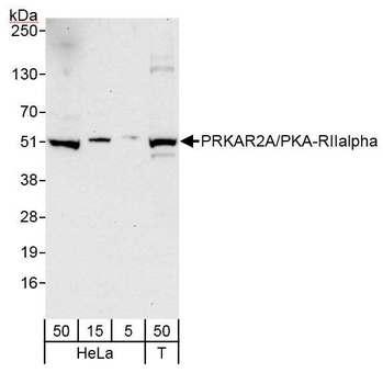 PRKAR2A/PKA-RIIalpha Antibody