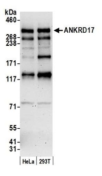 ANKRD17 Antibody