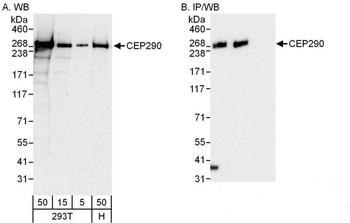 CEP290 Antibody