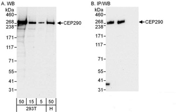 Rabbit anti-CEP290 Antibody