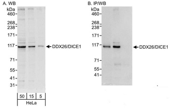 DDX26/DICE1 Antibody