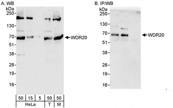 Rabbit anti-WDR20 Antibody