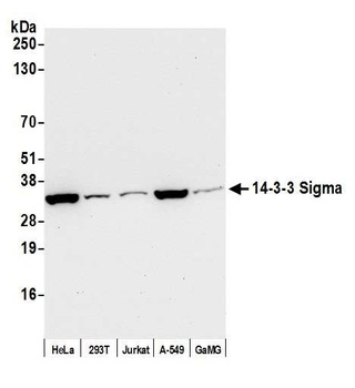 14-3-3 Sigma Antibody