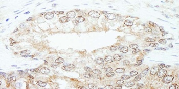 Rabbit anti-KPNA3 Antibody